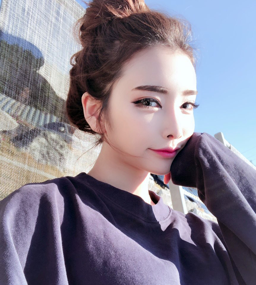 동작구치과 쉽고 빠르게 앞니만 개선하기 관련 이미지 1