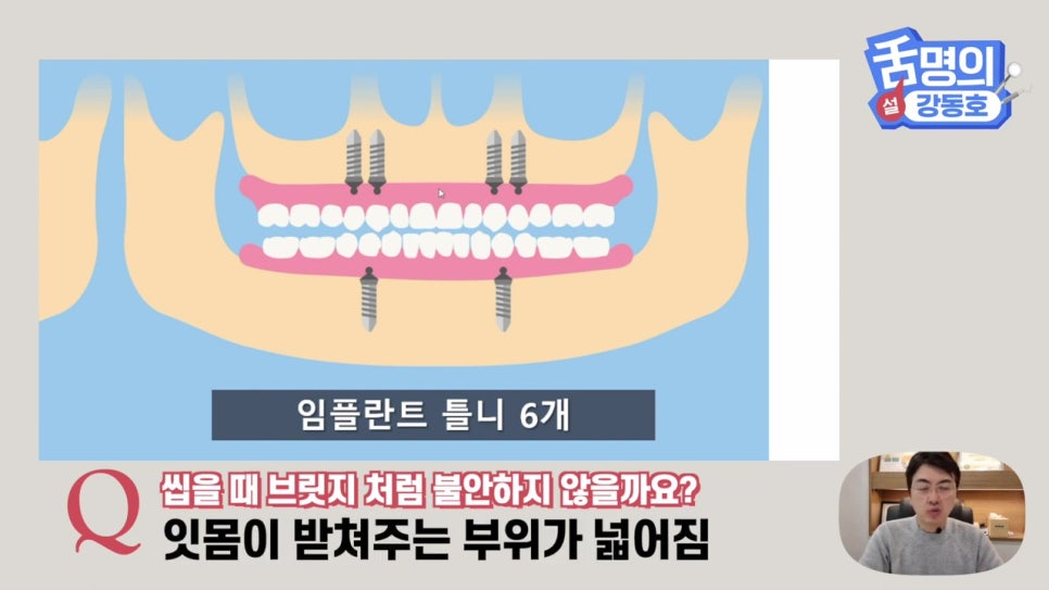 신림동치과, 다수의 치아상실 후.. 관련 이미지 19