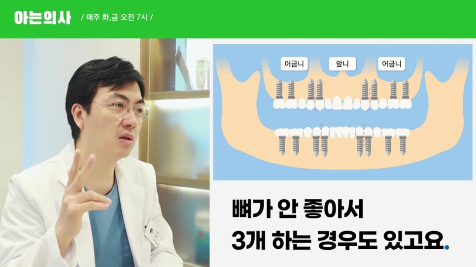 관악구임플란트, 최소 몇개? 관련 이미지 13