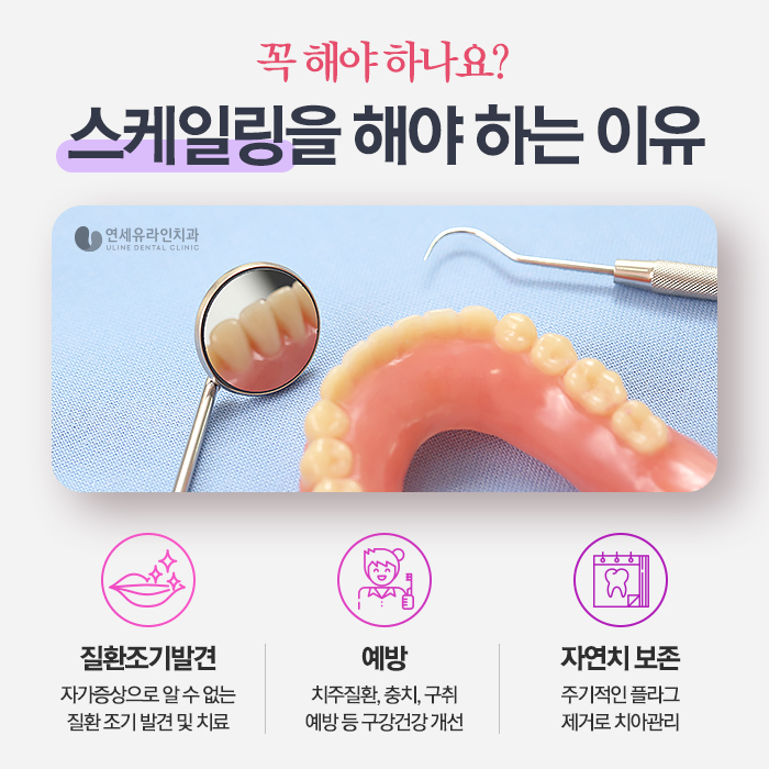 서울대입구역치과 치아 관리에 대한 협조 필수! 관련 이미지 8