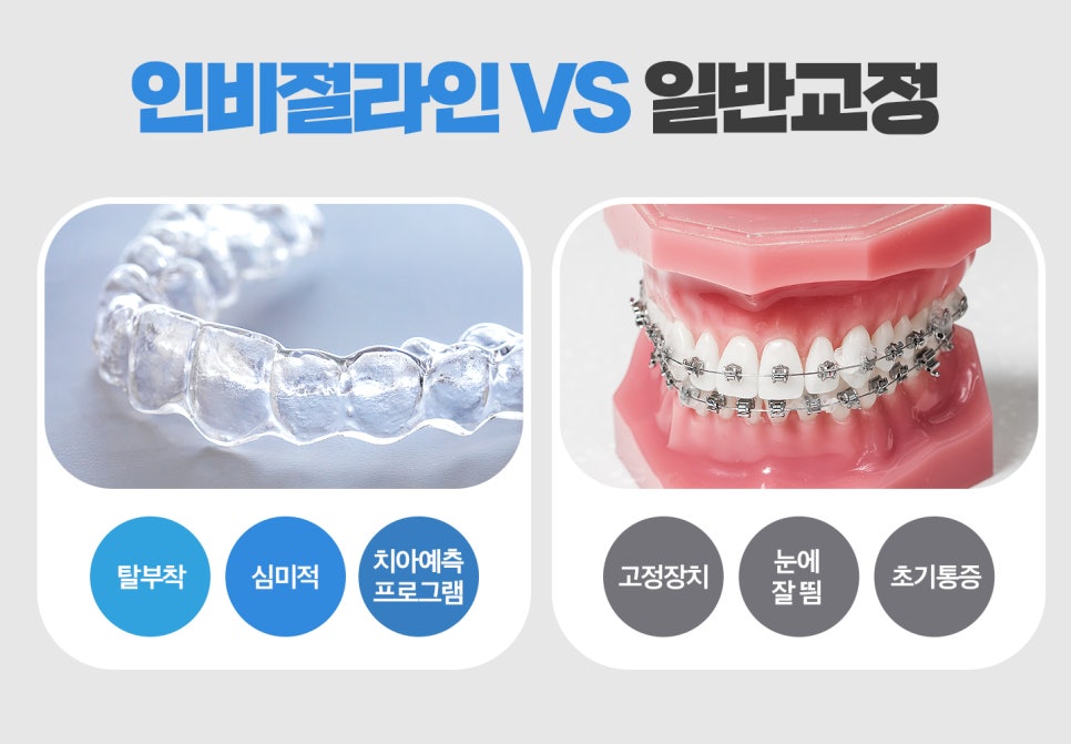 동작구치과 장치 착용, 돌출입 걱정 없어 관련 이미지 2