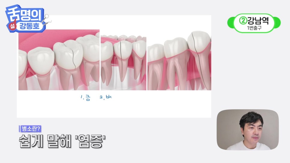 Sillim Station Dentist - Why Does It Hurt When Chewing? image 5