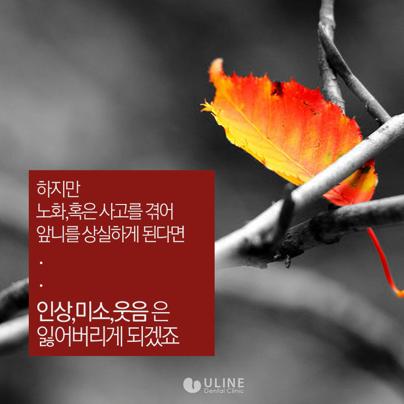 앞니임플란트가격 결과 모두 좋아 관련 이미지 2
