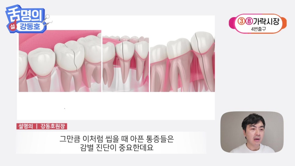 Sillim Station Dentist - Why Does It Hurt When Chewing? image 3