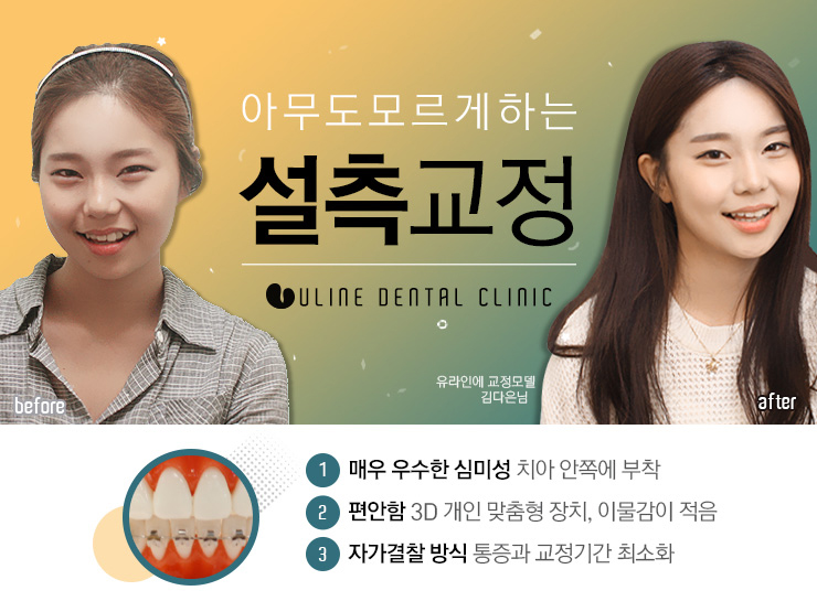 신도림치과 남들몰래 예뻐지고 싶다면 커몬 관련 이미지 6