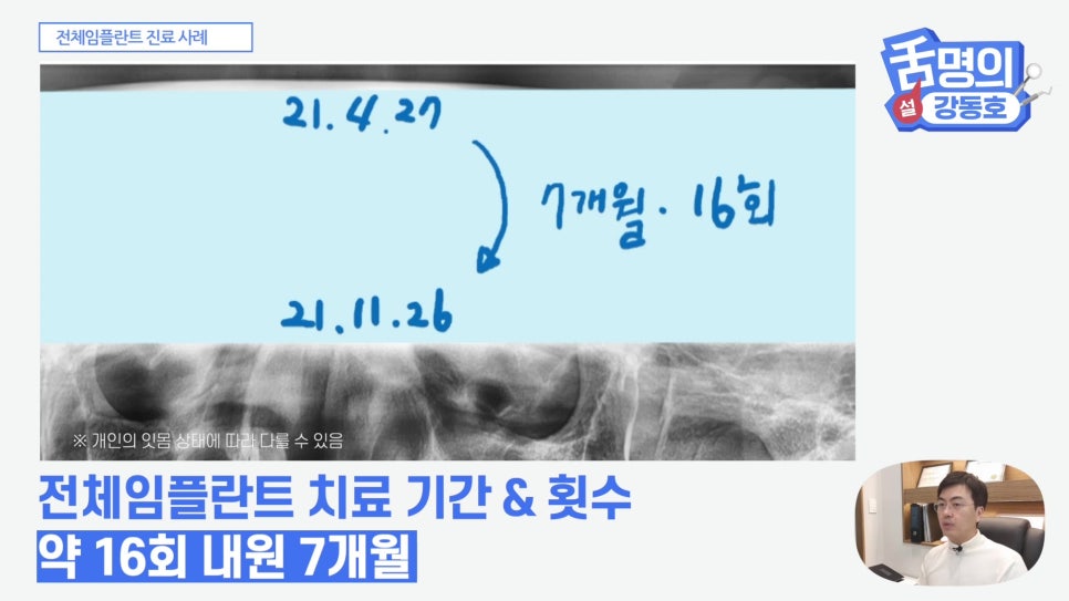 관악구치과 - 전체 임플란트, 시간&middot;횟수&middot;개수 총정리 관련 이미지 5