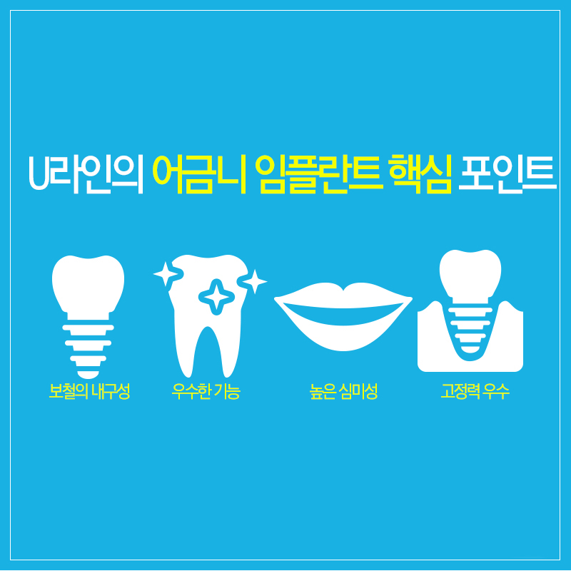 어금니임플란트통증 모두 줄였다! 관련 이미지 7