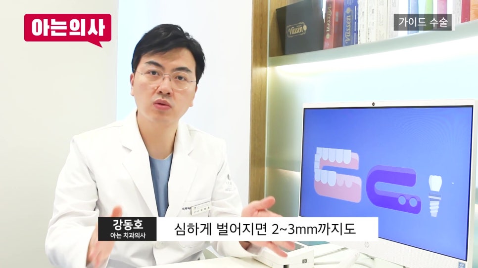 신림동치과, 디지털 임플란트 오해와 진실 관련 이미지 17