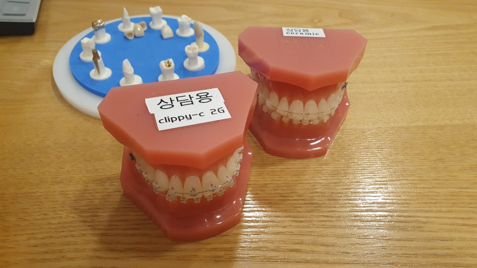 클리피씨교정기간 때문에 선택했어요 관련 이미지 3