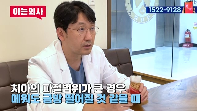 치아 부러짐, 파절엔 임플란트가 답? 관련 이미지 17