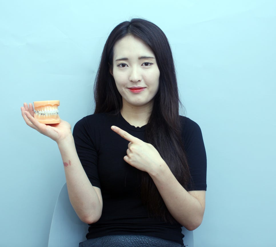 아랫니부분교정 착한 비용으로 성공적 관련 이미지 3