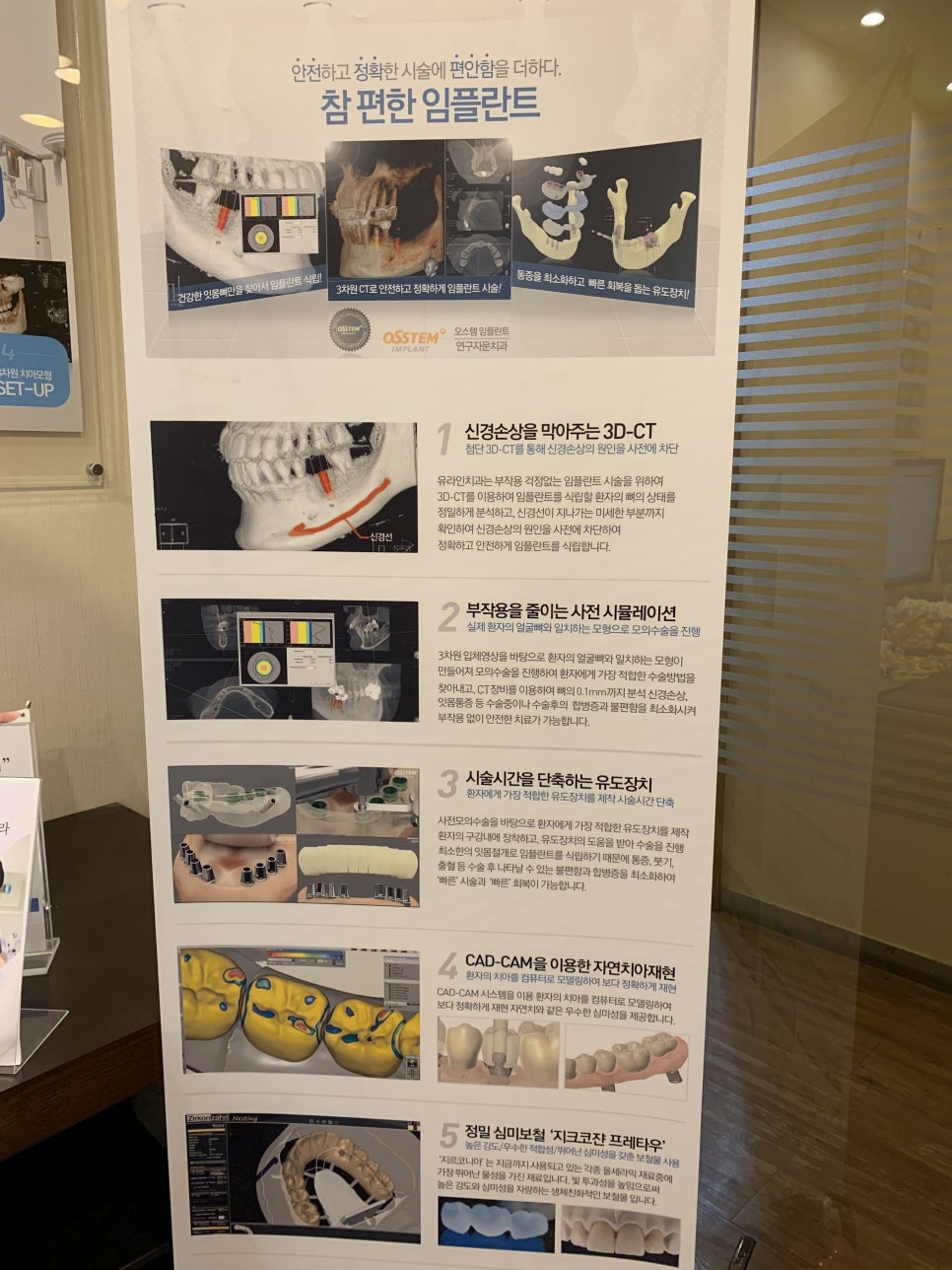 어금니임플란트비용 그리웠던 시간 관련 이미지 4