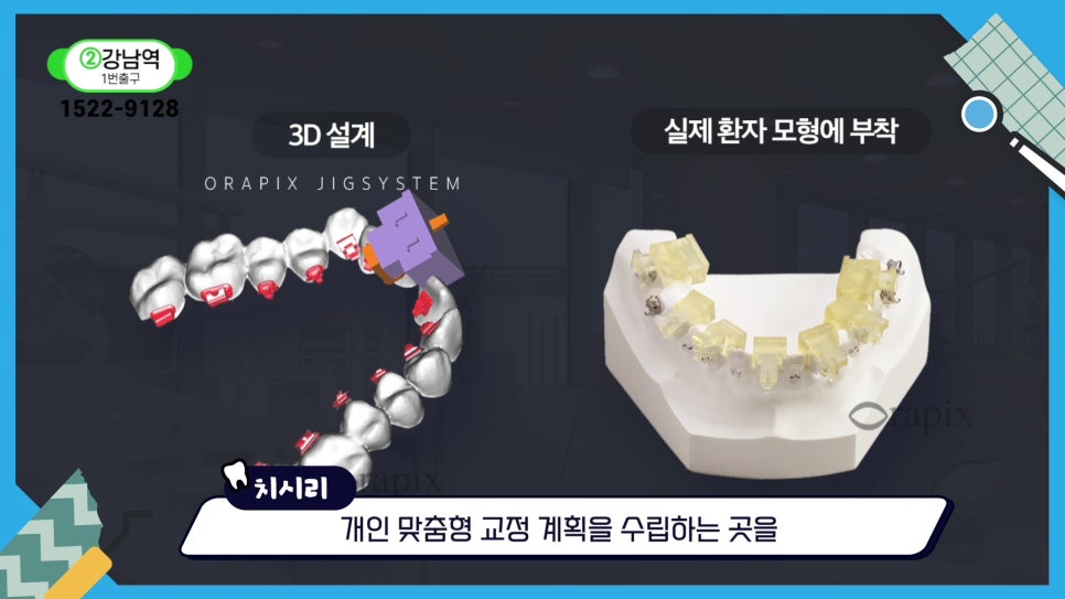 신림치아교정 - 부정교합, 나쁜 ㅇㅇ 때문? 관련 이미지 20