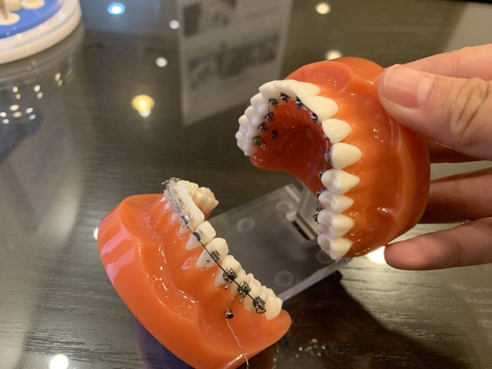 신림동치과 야물딱지게 시작해요 관련 이미지 3