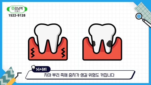 Can the Gaps Between Your Teeth That Make You Look Older Be Fixed? image 23