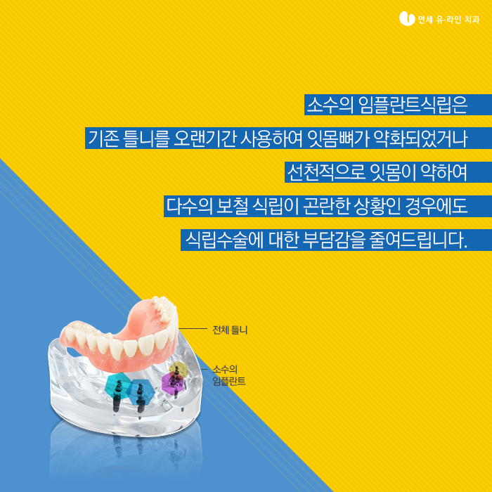 신림동치과 임플란트틀니비용 좋을수밖에! 관련 이미지 6
