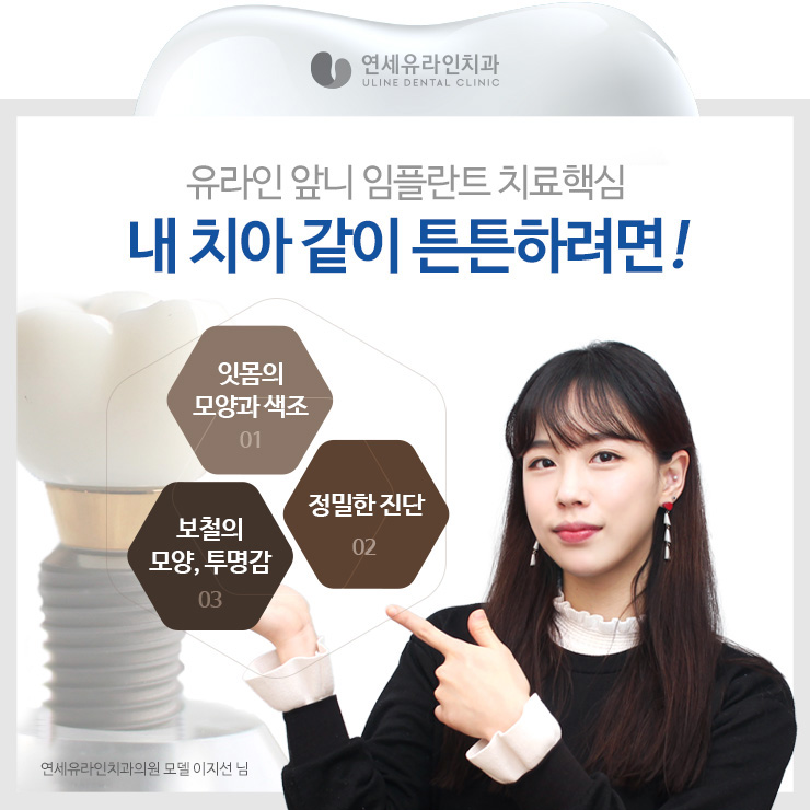 신림동치과 앞니임플란트가격 효율적 관련 이미지 8