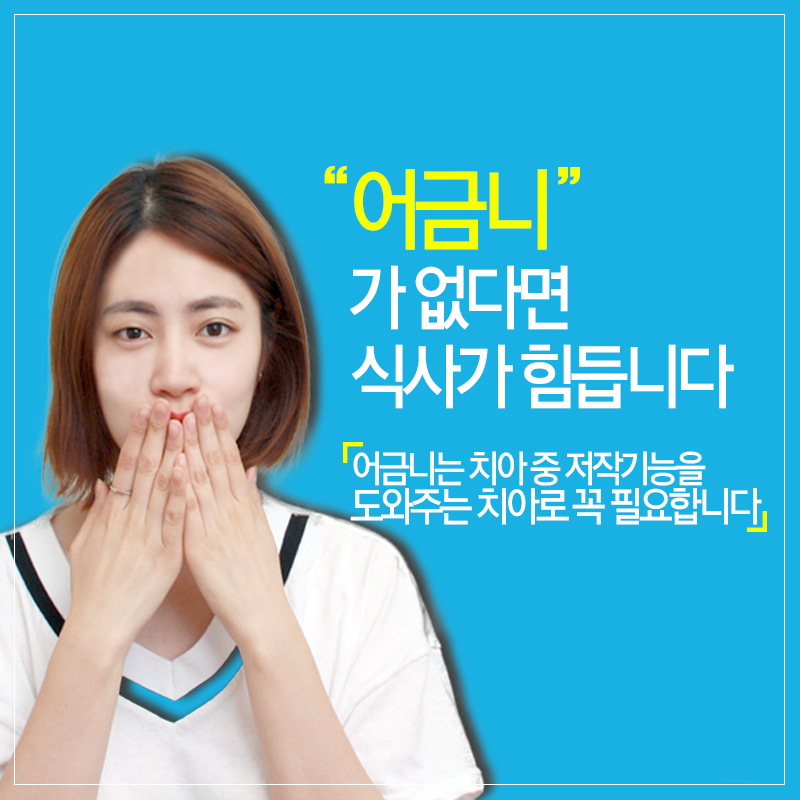 어금니임플란트통증 모두 줄였다! 관련 이미지 3