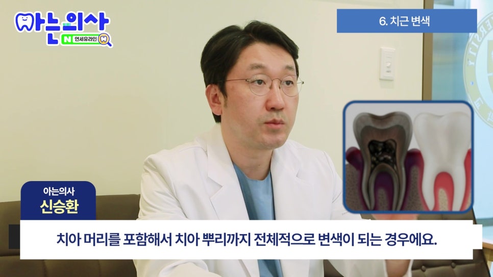 가락시장역치과 - 잇몸 왜 까매질까 관련 이미지 19