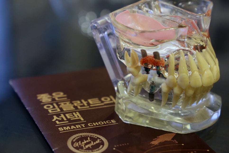 신림동치과 갑작스럽 치아상실, 가만히 두지말고 관련 이미지 3