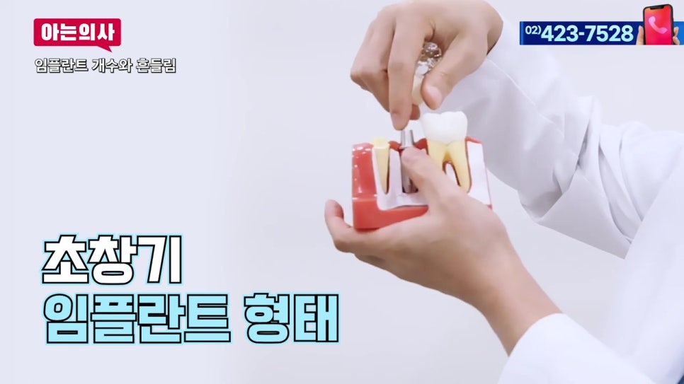 신림역치과, 임플란트 나사가 풀린다? 관련 이미지 4