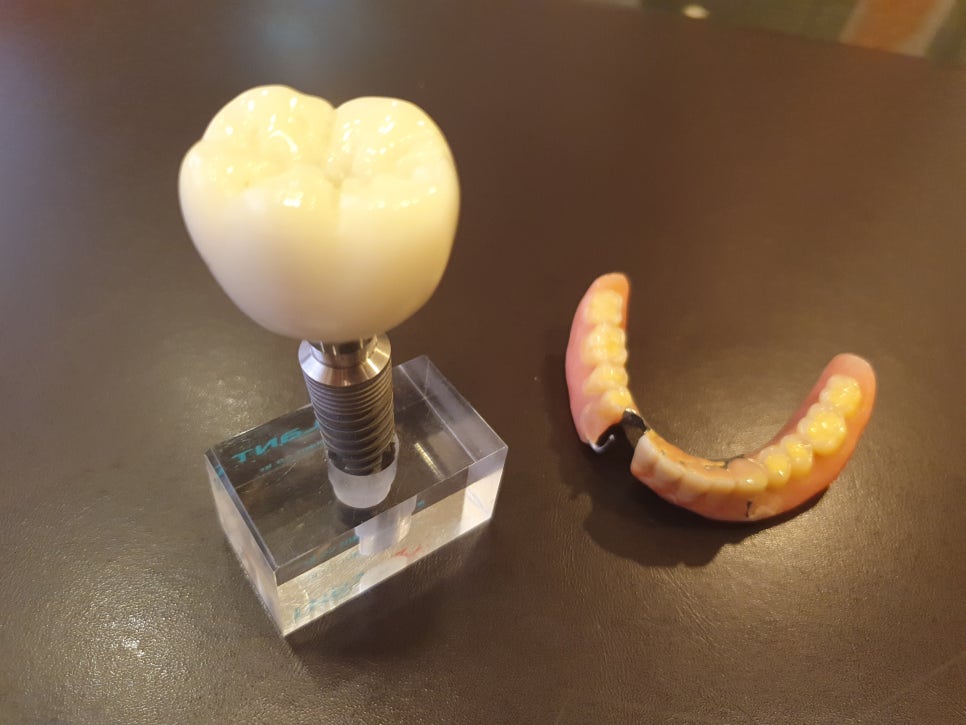 문정동치과 빠른결과 누구나 원하죠 관련 이미지 1