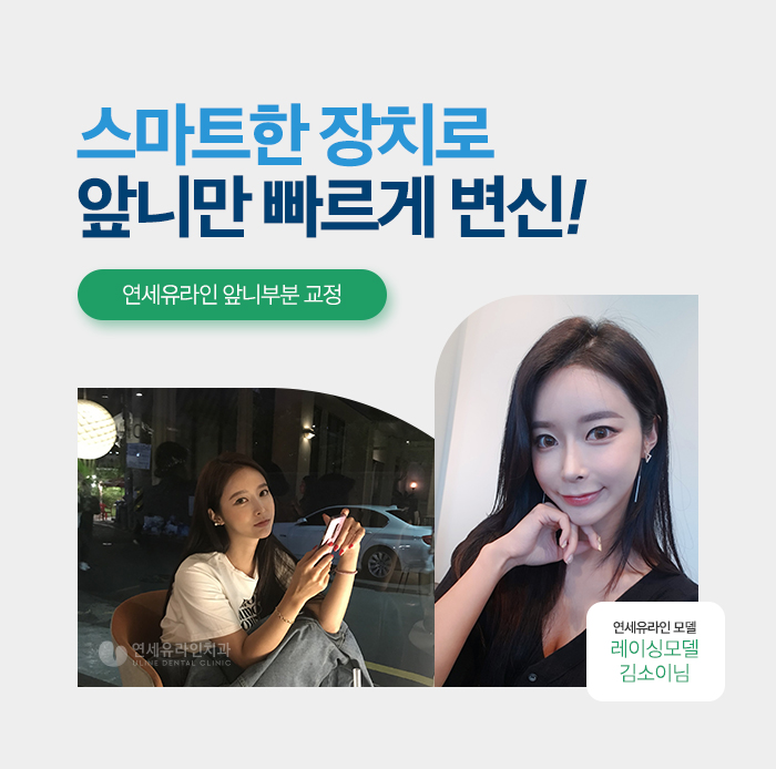 앞니부분교정기간 눈 깜짝 할 사이에! 관련 이미지 3