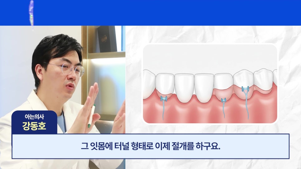 관악구 신림동치과 - 치아가 길어보이는 이유 관련 이미지 25