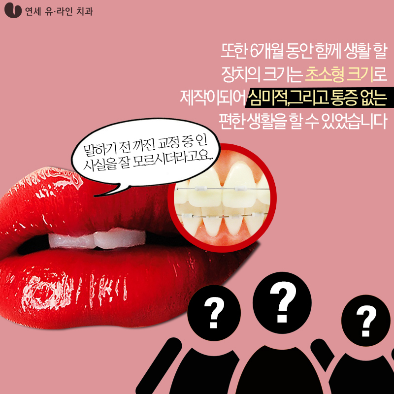 벌어진앞니교정 콤플렉스 빠이! 관련 이미지 4