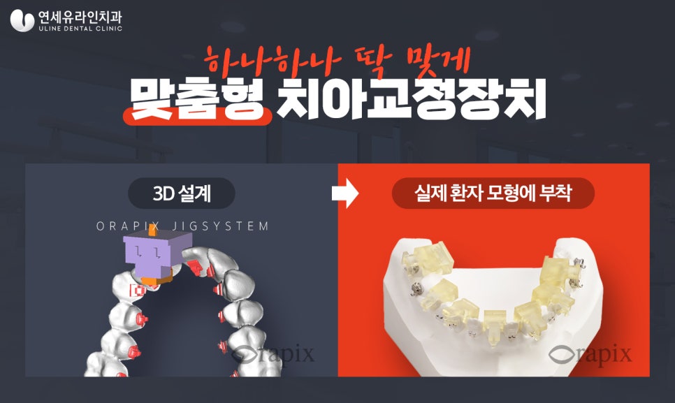 강남역교정치과 체계적인 시스템으로 관련 이미지 9