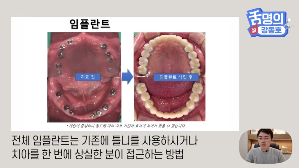 신림동치과, 다수의 치아상실 후.. 관련 이미지 11