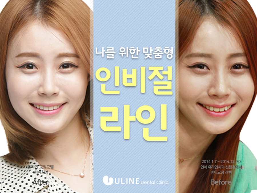 대림역치과 어디가 좋을까 관련 이미지 6