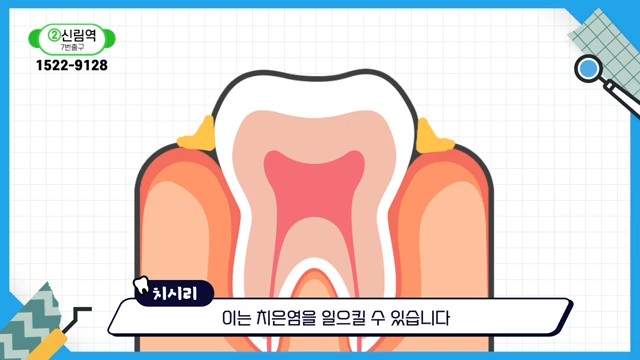 Do Braces Weaken Your Gums? A Fact Check by a Sinlim Dental Clinic image 19