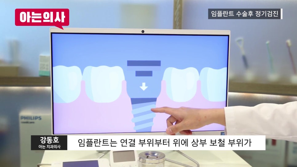 신림역임플란트 후, 정기검진 안 하면 관련 이미지 7