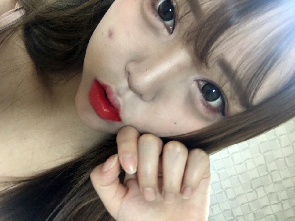 관악구치과 그동안 왜 망설였을까 관련 이미지 5