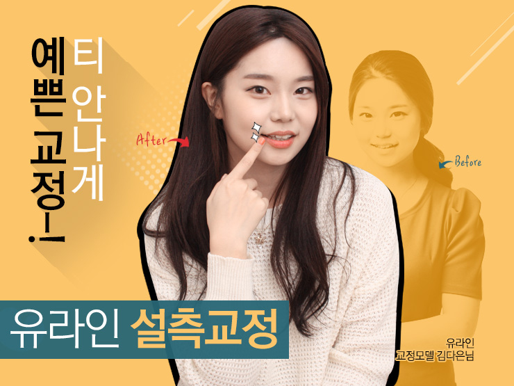 신도림치과 남들몰래 예뻐지고 싶다면 커몬 관련 이미지 1