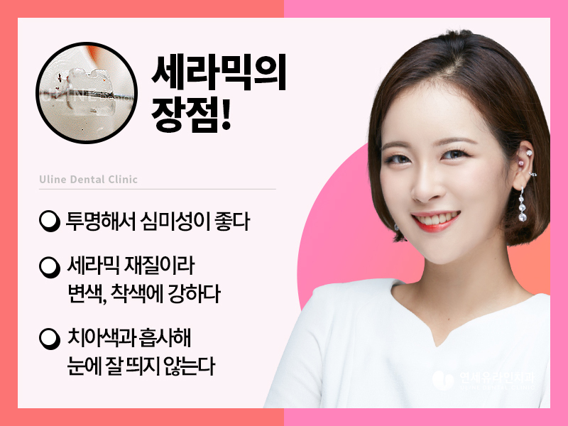 돌출입 세라믹교정 메탈교정 뭐가 좋을까! 관련 이미지 6