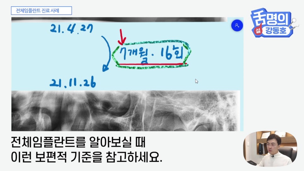 관악구치과 - 전체 임플란트, 시간&middot;횟수&middot;개수 총정리 관련 이미지 17