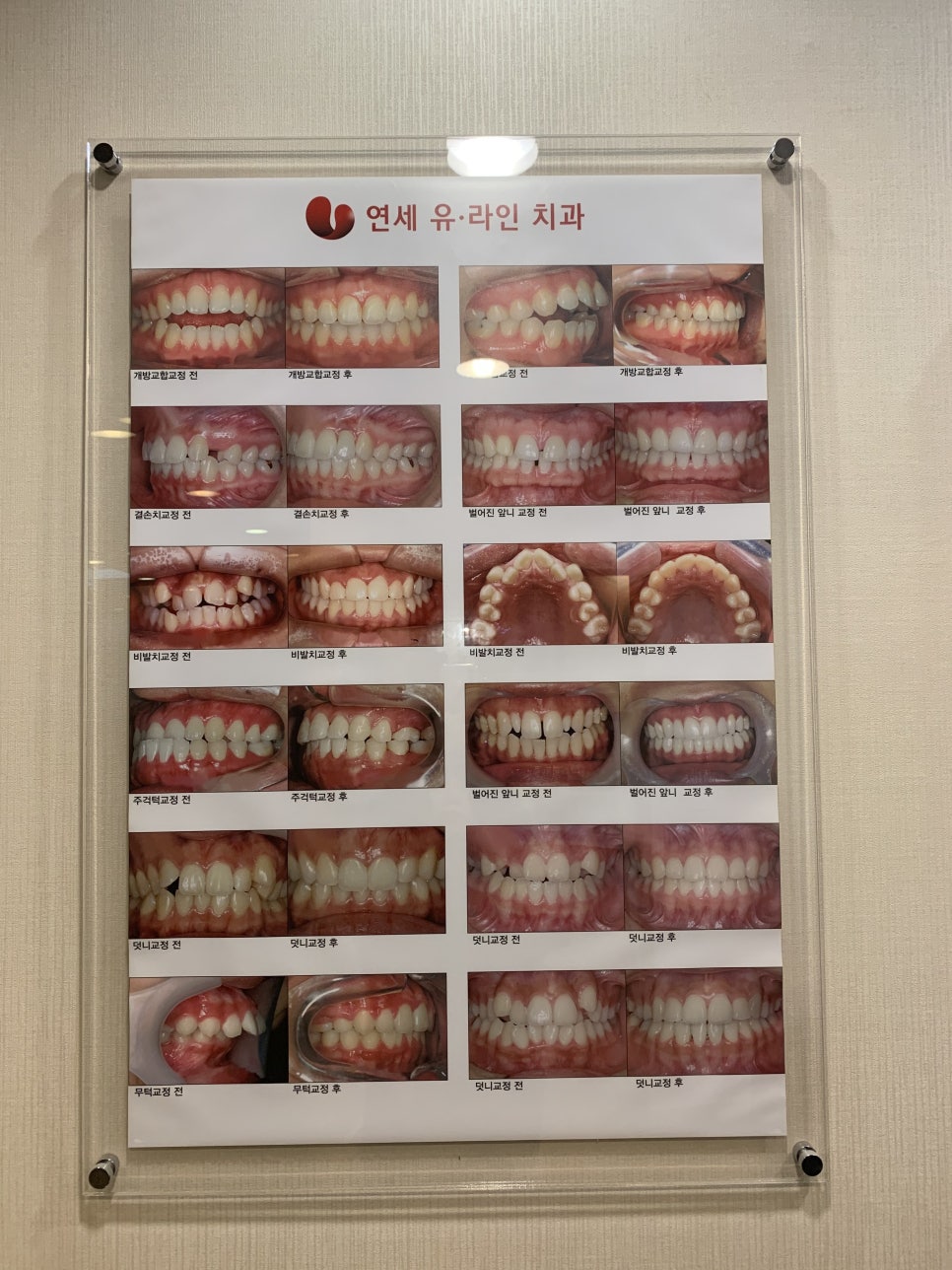 관악구치과 투자한 이상의 결과 관련 이미지 5