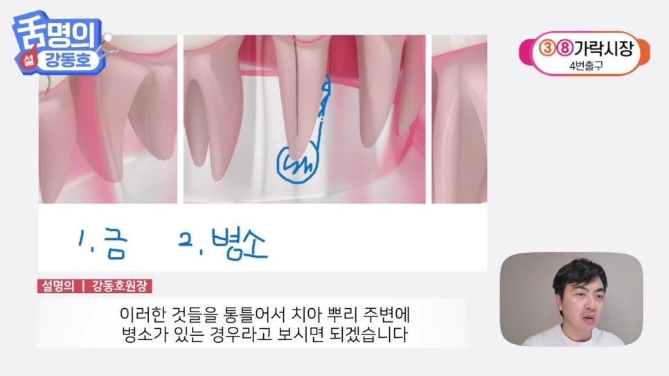 역삼역야간진료치과, 씹을 때마다 아파? 관련 이미지 10