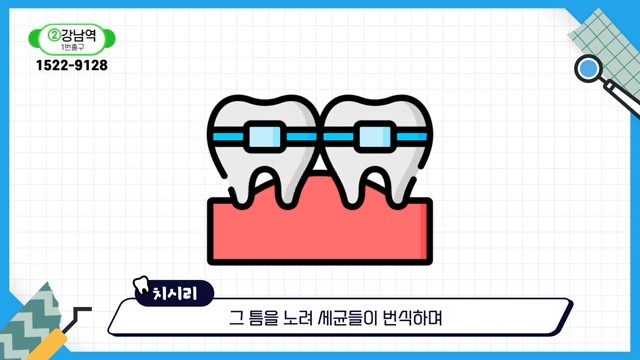 Do Braces Weaken Your Gums? A Fact Check by a Sinlim Dental Clinic image 13