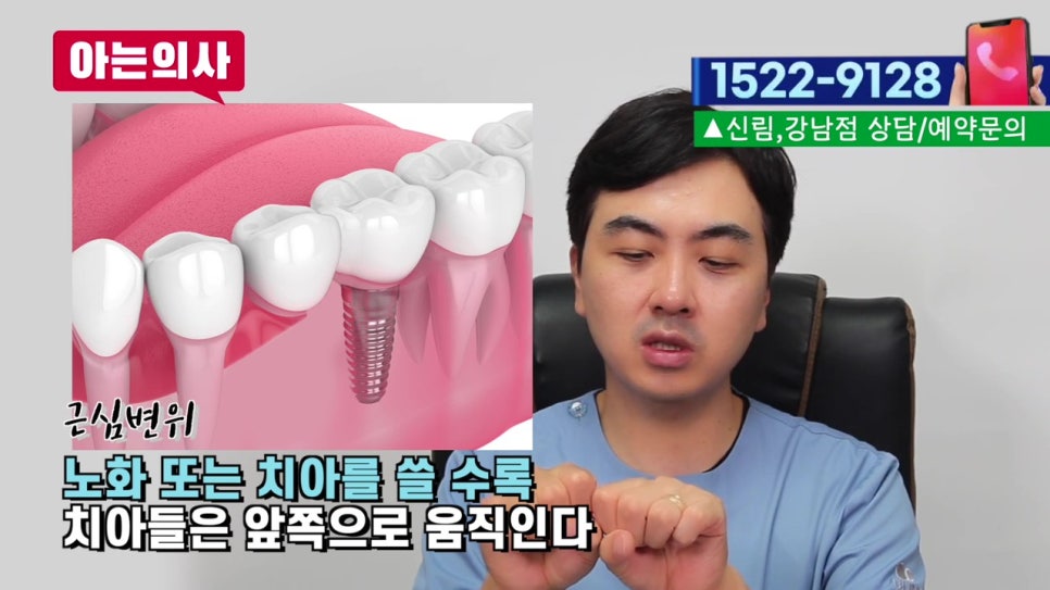 강남역임플란트 후 음식물 왜 끼지? 관련 이미지 19