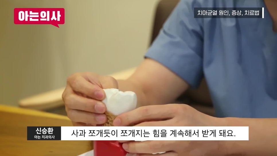 치아크랙, 충치보다 무섭다? 관련 이미지 4