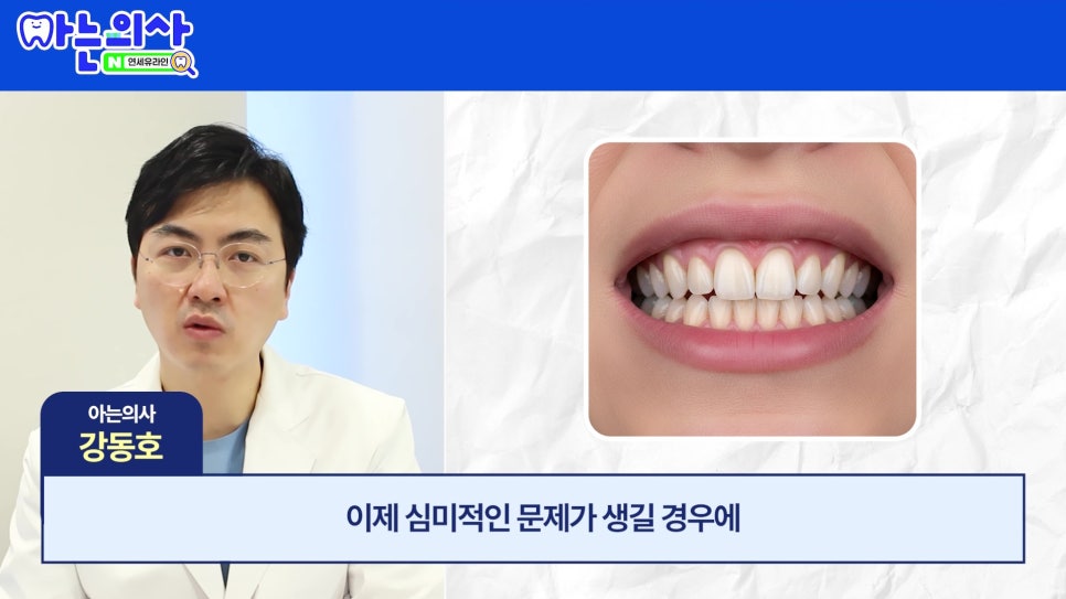 관악구 신림동치과 - 치아가 길어보이는 이유 관련 이미지 20