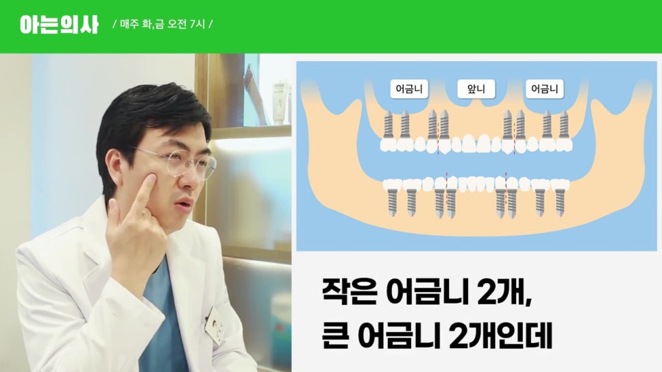 관악구임플란트, 최소 몇개? 관련 이미지 10