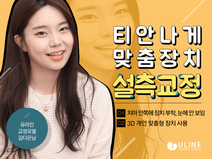 신도림치과 남들몰래 예뻐지고 싶다면 커몬 관련 이미지 7