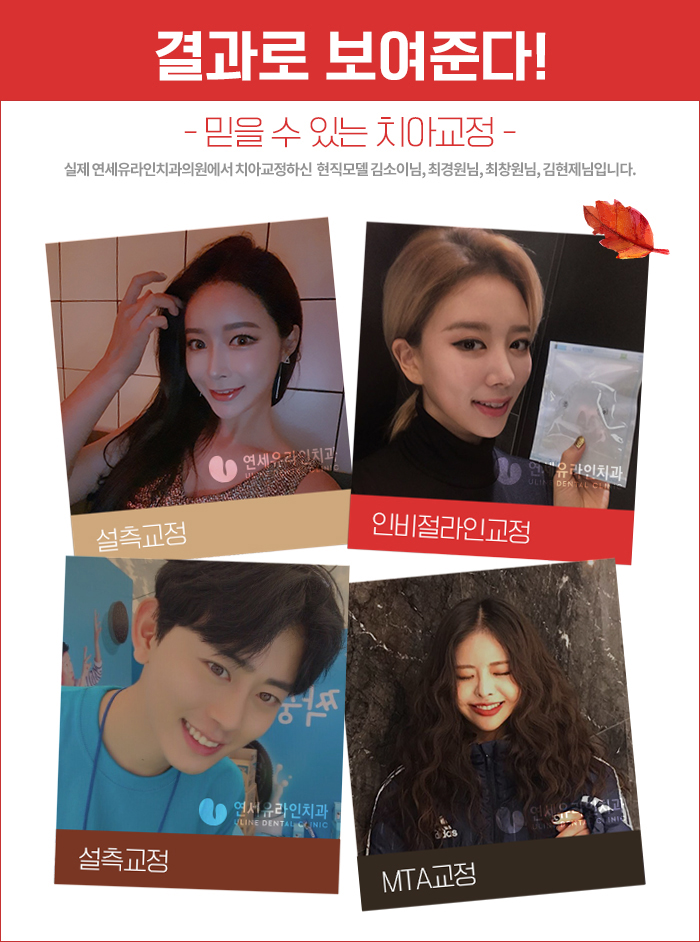 벌어진앞니교정 미루면 나만 손해! 관련 이미지 3
