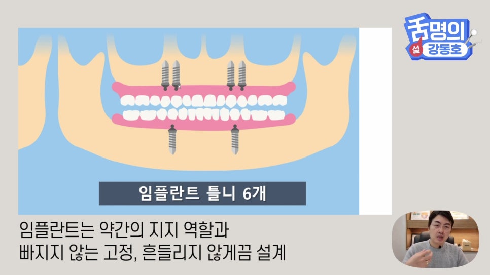 Dental Implants at Sillim Station: When There Is Not Enough Jawbone image 16