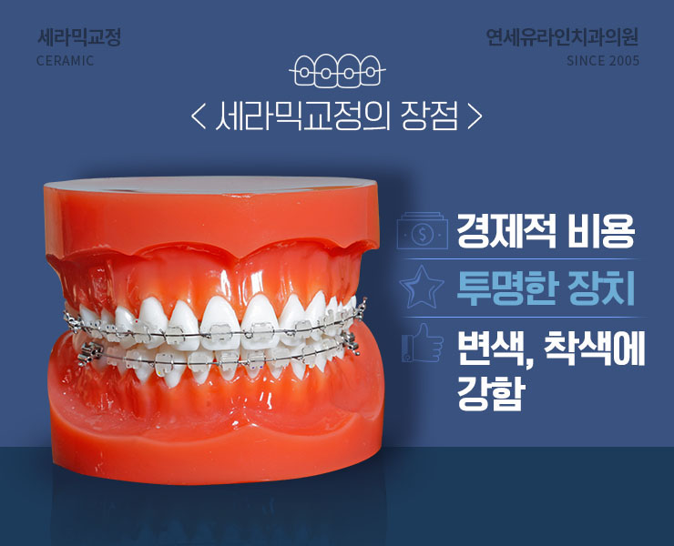 세라믹교정후기 오늘부터 시작할래 관련 이미지 3