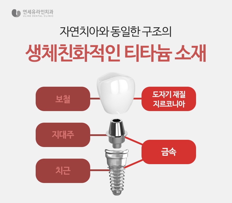 송파구치과 신중한 선택을 위해 관련 이미지 8